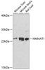 Western blot analysis of extracts of various cell lines using NMNAT1 Polyclonal Antibody at dilution of 1:1000.