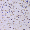 Immunohistochemistry of paraffin-embedded Rat brain using NUDC Polyclonal Antibody at dilution of  1:100 (40x lens).