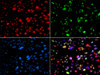 Immunofluorescence analysis of GFP-RNF168 transgenic U2OS cells using PNKP Polyclonal Antibody