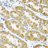 Immunohistochemistry of paraffin-embedded Human stomach using POLG2 Polyclonal Antibody at dilution of  1:100 (40x lens).