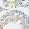Immunohistochemistry of paraffin-embedded Mouse testis using POLG2 Polyclonal Antibody at dilution of  1:100 (40x lens).