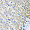 Immunohistochemistry of paraffin-embedded Human liver damage using RBP2 Polyclonal Antibody at dilution of  1:100 (40x lens).