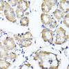 Immunohistochemistry of paraffin-embedded Human stomach using RBP2 Polyclonal Antibody at dilution of  1:100 (40x lens).