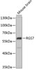 Western blot analysis of extracts of Mouse brain using RGS7 Polyclonal Antibody at dilution of 1:1000.