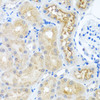Immunohistochemistry of paraffin-embedded Rat kidney using RPS2 Polyclonal Antibody at dilution of  1:100 (40x lens).