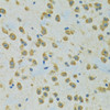 Immunohistochemistry of paraffin-embedded Rat brain using RPS7 Polyclonal Antibody at dilution of  1:100 (40x lens).