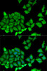 Immunofluorescence analysis of U2OS cells using RPS7 Polyclonal Antibody