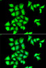 Immunofluorescence analysis of HeLa cells using MSRB1 Polyclonal Antibody