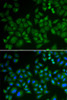 Immunofluorescence analysis of HeLa cells using SMPD1 / ASM Polyclonal Antibody