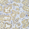 Immunohistochemistry of paraffin-embedded Human kidney using SPTLC1 Polyclonal Antibody at dilution of  1:100 (40x lens).