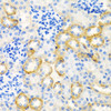 Immunohistochemistry of paraffin-embedded Rat kidney using STC1 Polyclonal Antibody at dilution of  1:100 (40x lens).