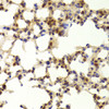 Immunohistochemistry of paraffin-embedded Mouse lung using TAF1C Polyclonal Antibody at dilution of  1:100 (40x lens).