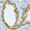 Immunohistochemistry of paraffin-embedded Mouse lung using TAF1C Polyclonal Antibody at dilution of  1:100 (40x lens).