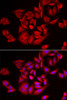 Immunofluorescence analysis of U2OS cells using TLK2 Polyclonal Antibody