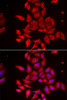 Immunofluorescence analysis of U2OS cells using TMOD4 Polyclonal Antibody