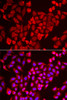 Immunofluorescence analysis of U2OS cells using TNP2 Polyclonal Antibody