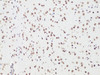 Immunohistochemistry of paraffin-embedded Rat brain using Bcl9 Polyclonal Antibody at dilution of  1:100 (20x lens).