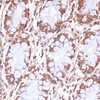 Immunohistochemistry of paraffin-embedded Human colon using CPT1B Polyclonal Antibody at dilution of  1:100 (40x lens).