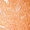 Immunohistochemistry of paraffin-embedded Mouse heart using CPT1B Polyclonal Antibody at dilution of  1:100 (40x lens).