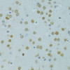 Immunohistochemistry of paraffin-embedded Rat brain using MUS81 Polyclonal Antibody at dilution of  1:100 (40x lens).