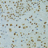 Immunohistochemistry of paraffin-embedded Mouse brain using MUS81 Polyclonal Antibody at dilution of  1:100 (40x lens).