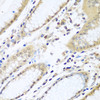 Immunohistochemistry of paraffin-embedded Human stomach using WDR48 Polyclonal Antibody at dilution of  1:100 (40x lens).