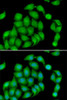 Immunofluorescence analysis of HeLa cells using ASPH Polyclonal Antibody