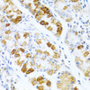 Immunohistochemistry of paraffin-embedded Human stomach using BMP3 Polyclonal Antibody at dilution of  1:100 (40x lens).