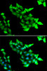 Immunofluorescence analysis of HeLa cells using KRIT1 Polyclonal Antibody