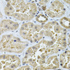 Immunohistochemistry of paraffin-embedded Human kidney using GALNT2 Polyclonal Antibody at dilution of  1:100 (40x lens).