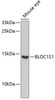 Western blot analysis of extracts of Mouse eye using BLOC1S1 Polyclonal Antibody at dilution of 1:1000.