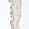 Immunohistochemistry of paraffin-embedded Mouse lung using MSTN Polyclonal Antibody at dilution of  1:100 (40x lens).