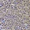 Immunohistochemistry of paraffin-embedded Mouse cancer using GPS1 Polyclonal Antibody at dilution of  1:100 (40x lens).