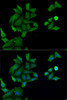 Immunofluorescence analysis of MCF7 cells using HABP2 Polyclonal Antibody