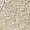 Immunohistochemistry of paraffin-embedded Mouse brain using KCND3 Polyclonal Antibody at dilution of  1:100 (40x lens).