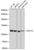 Western blot analysis of extracts of various cell lines using MYO1C Polyclonal Antibody at dilution of 1:1000.