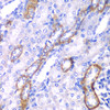 Immunohistochemistry of paraffin-embedded Rat kidney using MYO1C Polyclonal Antibody at dilution of  1:100 (40x lens).