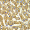 Immunohistochemistry of paraffin-embedded Human liver damage using MYO1C Polyclonal Antibody at dilution of  1:100 (40x lens).