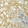 Immunohistochemistry of paraffin-embedded Human esophagus using MYO1C Polyclonal Antibody at dilution of  1:100 (40x lens).
