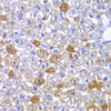 Immunohistochemistry of paraffin-embedded Mouse liver using MYO1C Polyclonal Antibody at dilution of  1:100 (40x lens).