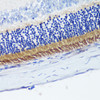 Immunohistochemistry of paraffin-embedded Rat retina using PDE6B Polyclonal Antibody at dilution of  1:200 (40x lens).
