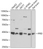 Western blot analysis of extracts of various cell lines using PPID Polyclonal Antibody at dilution of 1:1000.