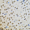 Immunohistochemistry of paraffin-embedded Rat brain using PPID Polyclonal Antibody at dilution of  1:100 (40x lens).