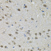 Immunohistochemistry of paraffin-embedded Mouse brain using PPID Polyclonal Antibody at dilution of  1:100 (40x lens).