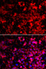 Immunofluorescence analysis of U2OS cells using QARS Polyclonal Antibody