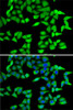 Immunofluorescence analysis of A-549 cells using RBBP5 Polyclonal Antibody