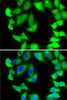 Immunofluorescence analysis of MCF7 cells using RPS5 Polyclonal Antibody