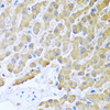 Immunohistochemistry of paraffin-embedded Human liver using CCL8 Polyclonal Antibody at dilution of  1:100 (40x lens).