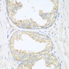 Immunohistochemistry of paraffin-embedded Human prostate using SGCB Polyclonal Antibody at dilution of  1:100 (40x lens).