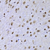 Immunohistochemistry of paraffin-embedded Mouse brain using SOX5 Polyclonal Antibody at dilution of  1:100 (40x lens).
